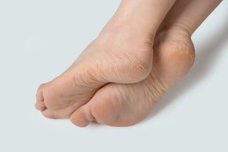 heel care